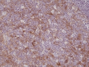 IHC testing of formalin fixed and paraffin embedded human tonsil tissue with recombinant CD11b antibody at 1:200 dilution. HIER: steam section in pH6 citrate buffer for 20 min and allow to cool prior to staining.