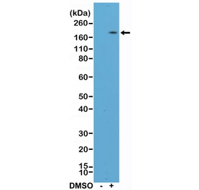 Western blot testing of lysate from human HL60 cells, nontreated (-) or treated (+) with DMSO, with recombinant CD11b antibody at 1:400 dilution. Expected molecular weight: 127~170 kDa depending on glycosylation level.~