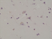 IHC testing of formalin fixed and paraffin embedded human brain tissue with recombinant phospho-GluR1 antibody at 1:200 dilution. HIER: steam section in pH6 citrate buffer for 20 min and allow to cool prior to staining.