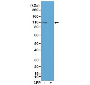 Western blot testing of lysate from mouse brain tissue, untreated (-) or dephosphorylated (+) with Lambda Protein Phosphatase ( lambda;PP), with recombinant phospho-GluR1 antibody at 1:200 dilution. Predicted molecular weight ~102 kDa.~