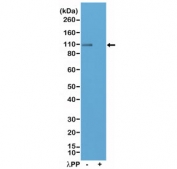 Western blot testing of lysate from mouse brain tissue, untreated (-) or dephosphorylated (+) with Lambda Protein Phosphatase (λPP), with recombinant phospho-GluR1 antibody at 1:200 dilution. Predicted molecular weight ~102 kDa.