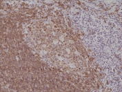 IHC testing of formalin fixed and paraffin embedded human tonsil tissue with recombinant CD79a antibody at 1:200 dilution. HIER: steam section in pH6 citrate buffer for 20 min and allow to cool prior to staining.