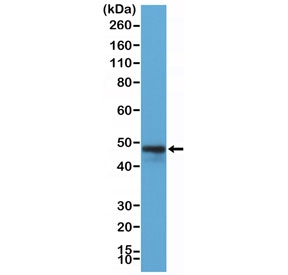 Western blot testing of Raji cell lysate with recombinant CD79a antibody at 1:200 dilution. Expected molecular weight: 25-47 kDa depending on glycosylation level.~