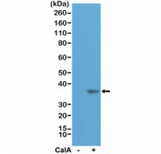 Western blot testing of lysate from human HeLa cells, untreated (-) or treated (+) with Calyculin A (CalA), with recombinant phospho-EIF2A antibody at 1:200 dilution. Predicted molecular weight ~36 kDa.
