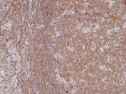 IHC testing of formalin fixed and paraffin embedded human tonsil tissue with recombinant NFKB1 antibody at 1:200 dilution. HIER: steam section in pH6 citrate buffer for 20 min and allow to cool prior to staining.