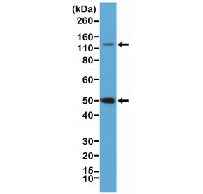 Western blot testing of HeLa cell lysate with recombinant NFKB1 antibody at 1:100 dilution. Expected molecular weight: 50 kDa / 105 kDa.~