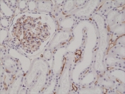 IHC testing of formalin fixed and paraffin embedded human kidney tissue with recombinant CD34 antibody at 1:200 dilution. HIER: steam section in pH6 citrate buffer for 20 min and allow to cool prior to staining.