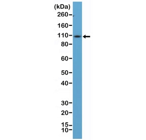 Western blot testing of mouse spleen tissue lysate using recombinant CD34 antibody at 1:100 dilution.Observed molecular weight: 41~110 kDa depending on level of glycosylation.~