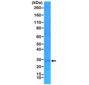 Western blot testing of human MCF7 cell lysate with recombinant p27 antibody at 1:1000. Expected molecular weight: 22~27 kDa.