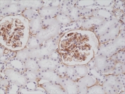 IHC testing of formalin fixed and paraffin embedded human kidney tissue with recombinant PDGFRB antibody at 1:200 dilution. HIER: steam section in pH6 citrate buffer for 20 min and allow to cool prior to staining.