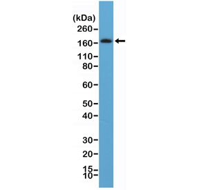 Western blot testing of human brain tissue lysate with recombinant PDGFRB antibody at 1:100. Expected molecular weight: 123-190 kDa depending on level of glycosylation.~
