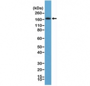 Western blot testing of human brain tissue lysate with recombinant PDGFRB antibody at 1:100. Expected molecular weight: 123-190 kDa depending on level of glycosylation.