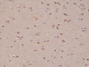 IHC testing of formalin fixed and paraffin embedded human brain tissue with recombinant S100B antibody at 1:1000 dilution. HIER: steam section in pH6 citrate buffer for 20 min and allow to cool prior to staining.