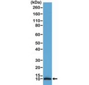 Western blot testing of human brain tissue lysate with recombinant S100B antibody at 1:100 dilution. Predicted molecular weight ~11 kDa.