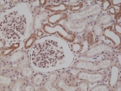 IHC testing of formalin fixed and paraffin embedded human kidney tissue with recombinant MyD88 antibody at 1:250 dilution. HIER: steam section in pH6 citrate buffer for 20 min and allow to cool prior to staining.