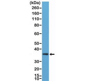 Western blot testing of human K562 cell lysate with recombinant MyD88 antibody at 1:100 dilution. Predicted molecular weight ~33 kDa.~