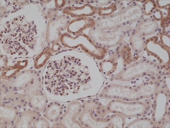 IHC testing of formalin fixed and paraffin embedded human kidney tissue with recombinant MyD88 antib