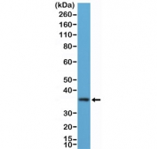 Western blot testing of human K562 cell lysate with recombinant MyD88 antibody at 1:100 dilution. Predicted molecular weight ~33 kDa.