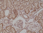 IHC testing of formalin fixed and paraffin embedded human kidney tissue with recombinant BRAF antibody at 1:500 dilution. HIER: steam section in pH6 citrate buffer for 20 min and allow to cool prior to staining.
