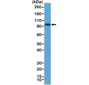 Western blot testing of human K562 cell lysate with recombinant BRAF antibody at 1:100 dilution. Predicted molecular weiight ~84 kDa.~