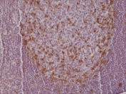 IHC testing of formalin fixed and paraffin embedded human tonsil tissue with recombinant PD-1 antibody at 1:500 dilution. HIER: steam section in pH6 citrate buffer for 20 min and allow to cool prior to staining.