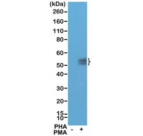 Western blot testing of lysate from Jurkat cells, untreated (-) or treated (+) with PHA and PMA, with recombinant PD-1 antibody at 1:100 dilution. Predicted molecular weight: 32-55 kDa depending on glycosylation level.~