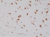 IHC testing of formalin fixed and paraffin embedded human brain tissue with recombinant NeuN antibody at 1:1000 dilution. HIER: steam section in pH6 citrate buffer for 20 min and allow to cool prior to staining.