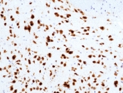 IHC testing of formalin fixed and paraffin embedded mouse brain tissue with recombinant NeuN antibody at 1:1000 dilution. HIER: steam section in pH6 citrate buffer for 20 min and allow to cool prior to staining.