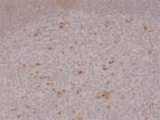 IHC testing of formalin fixed and paraffin embedded human tonsil tissue with recombinant OX40 antibody at 1:500 dilution. HIER: steam section in pH6 citrate buffer for 20 min and allow to cool prior to staining.