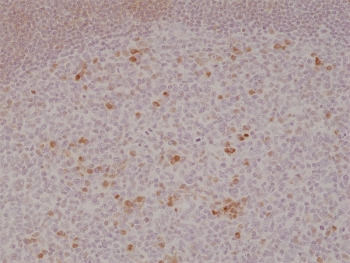 IHC testing of formalin fixed and paraffin embedded human tonsil tis