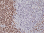 IHC testing of formalin fixed and paraffin embedded human tonsil tissue with recombinant CD5 antibody at 1:1000 dilution. HIER: steam section in pH6 citrate buffer for 20 min and allow to cool prior to staining.