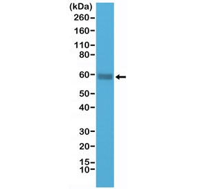 Western blot testing of human Jurkat cell lysate with recombinant CD5 antibody at 1:1000 dilution. Observed molecular weight: 55~67 kDa depending on glycosylation level.~