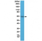 Western blot testing of human Jurkat cell lysate with recombinant CD5 antibody at 1:1000 dilution. Observed molecular weight: 55~67 kDa depending on glycosylation level.