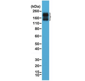 Western blot testing of human brain lysate with recombinant CD56 antibody at 1:2000 dilution. Predicted molecular weight: ~110 kDa (soluble fragment), ~120/125 kDa (GPI-anchored), 140/180 kDa (transmembrane isoforms).~