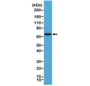 Western blot testing of human A431 cell lysate with recombinant PLAP antibody at 1:2000 dilution. Predicted molecular weight ~58 kDa but routinely visualized at 60-70 kDa.~