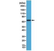 Western blot testing of human A431 cell lysate with recombinant PLAP antibody at 1:2000 dilution. Predicted molecular weight ~58 kDa but routinely visualized at 60-70 kDa.