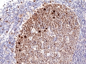 IHC testing of FFPE human tonsil tissue with recombinant Ki67 antibody. HIER: boil tissue sections in pH6, 10mM citrate buffer, for 10-20 min and allow to cool before testing.