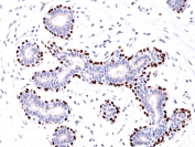 IHC testing of FFPE human breast tissue with recombinant p63 antibody. HIER: boil tissue sections in pH6, 10mM citrate buffer, for 10-20 min and allow to cool before testing.