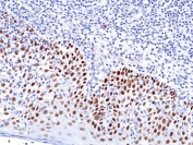 IHC testing of FFPE human tonsil tissue with recombinant p63 antibody. HIER: boil tissue sections in pH6, 10mM citrate buffer, for 10-20 min and allow to cool before testing.