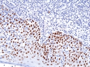 IHC testing of FFPE human tonsil tissue with recombinant p63 antibody. HIER: boil tissue sections in pH6, 10mM citrate buffer, for 10-20 min and allow to cool before testing.