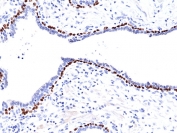 IHC testing of FFPE human prostate tissue with recombinant p63 antibody. HIER: boil tissue sections in pH6, 10mM citrate buffer, for 10-20 min and allow to cool before testing.