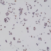 ICC staining of FFPE human 22RV1 cells with recombinant BAG-1 antibody at 1:2000.