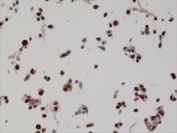 ICC staining of BAG-1L overexpressing FFPE LNCaP cells with recombinant BAG-1 antibody at 1:2000.