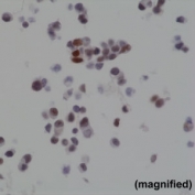 ICC staining of FFPE human 22RV1 cells with recombinant BAG-1 antibody at 1:2000.