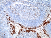 IHC staining of FFPE human tonsil tissue with recombinant PD-L1 antibody at 1:250.
