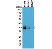 Western blot testing of human tumor cell line lysate with recombinant PD-L1 antibody at 1:1000. DU145 and LNCaP are prostate cancer cell lines with very minor PD-L1 expression. Predicted molecular weight ~34 kDa (unmodified), 45-70 kDa (glycosylated).