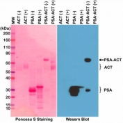 Western blot testing of PSA (purified from human seminal fluid), ACT (alpha 1-antichymotrypsin, from human plasma), and PSA-ACT complex, under non-reduced(-) or reduced(+) conditions, using recombinant Prostate Specific Antigen antibody at 1:2500.