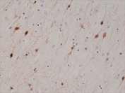 IHC staining of FFPE human brain tissue with recombinant Calretinin antibody at 1:1000.