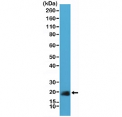 Western blot testing of human HeLa cell lysate with recombinant Caveolin-1 antibody at 1:40,000. Predicted molecular weight ~21 kDa.