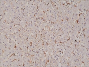 IHC staining of FFPE human liver tissue with recombinant Caveolin-1 antibody at 1:1000.